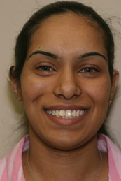 Cosmetic Dentistry