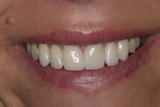 Modern Cosmetic Dentistry