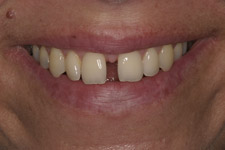 Modern Cosmetic Dentistry