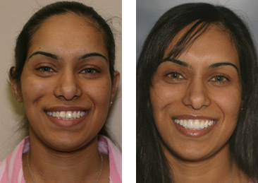 Cosmetic Dentistry