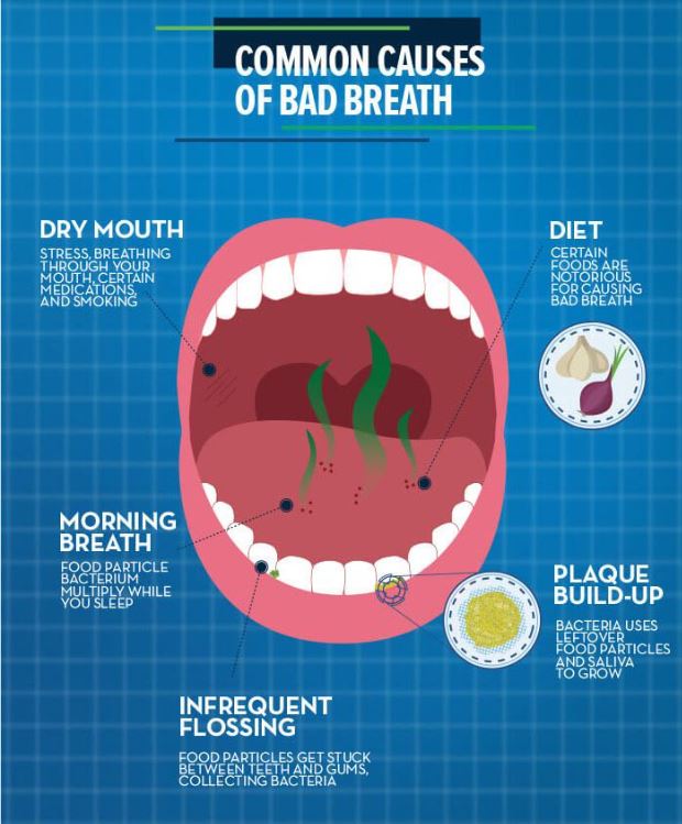 Causes of Bad Breath